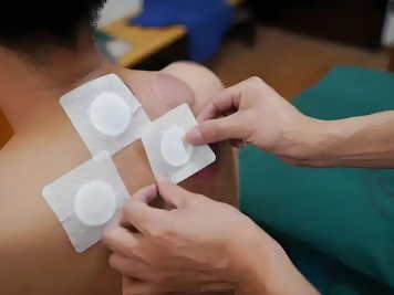 三伏贴定制穴位贴发热艾灸贴：传统智慧与现代科技的完美融合