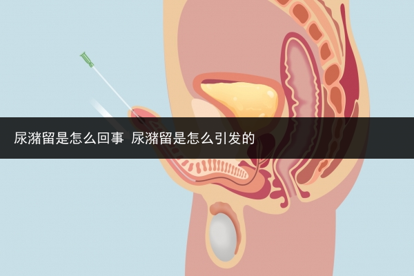 尿潴留是怎么回事 尿潴留是怎么引发的