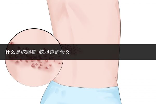 什么是蛇胆疮 蛇胆疮的含义