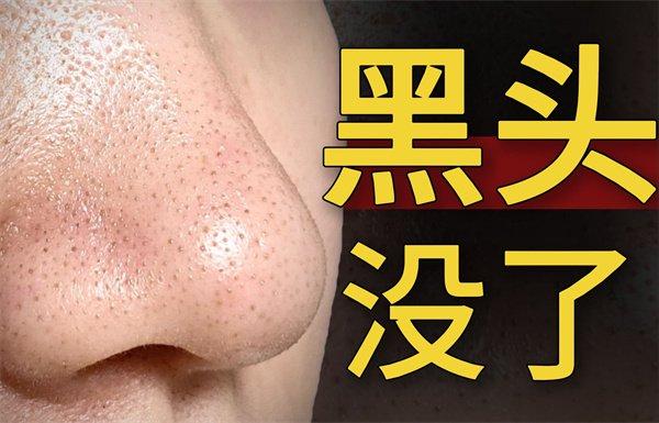 去黑頭產品哪個牌子好？去黑頭還不會大毛孔的護膚品排行榜